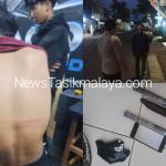 Diduga Bentrok Antar-Kelompok Motor di Jalan Ahmad Yani Tasikmalaya, Seorang Pelajar Dihantam Kapak hingga Tongkat Baseball