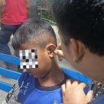 Gercep! Hanya Dua Menit, Petugas Damkar Kota Tasikmalaya Berhasil Evakuasi Baterai Jam dari Telinga Anak
