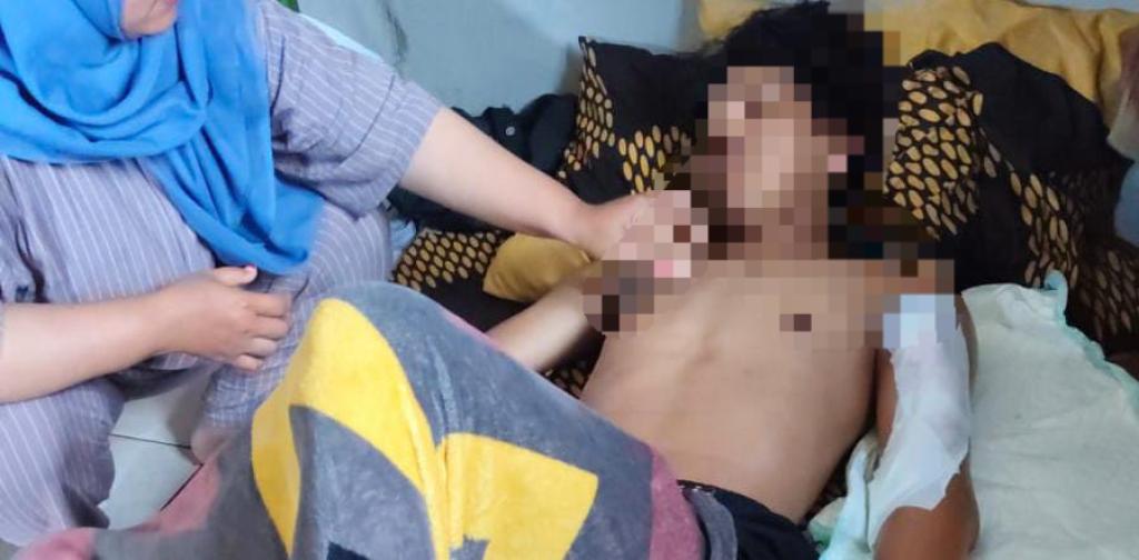 Dua Remaja Korban Pengeroyokan Geng Motor di Tasikmalaya Akhirnya Pulang Usai Lima Hari Dirawat