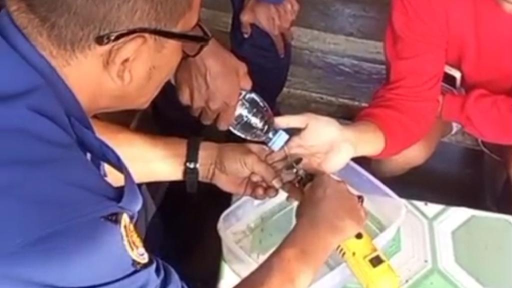 Cincin Stainless Jadi Petaka, Damkar Ciamis Turun Tangan Selamatkan Jari Warga