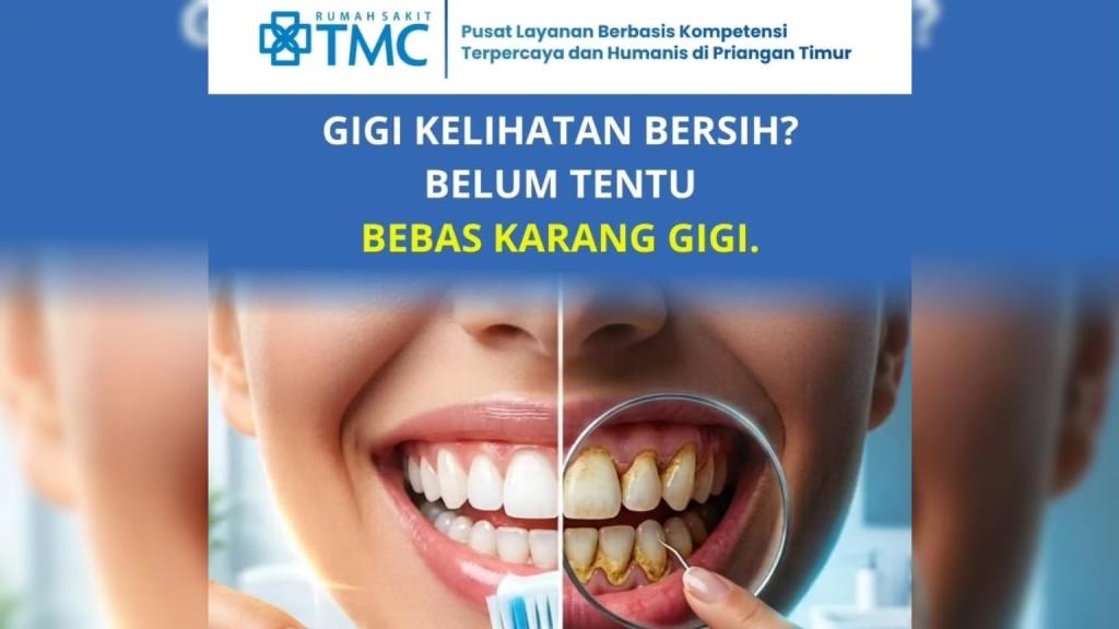 Gigi Terlihat Bersih Belum Tentu Bebas Karang Gigi, RS TMC Tasikmalaya Hadirkan Promo Scaling