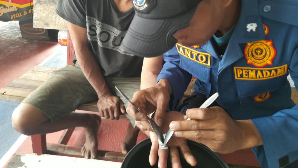 Jari Membengkak Akibat Cincin Titanium Terjepit, Warga Banjaranyar Ciamis Ditolong Petugas Damkar