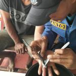 Jari Membengkak Akibat Cincin Titanium Terjepit, Warga Banjaranyar Ciamis Ditolong Petugas Damkar