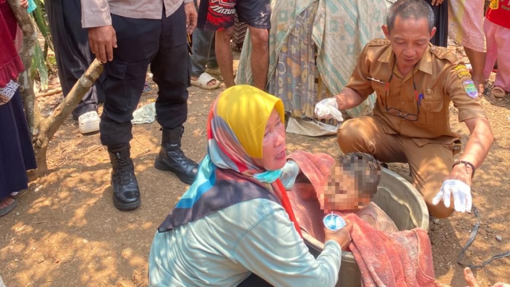 Terpeleset Saat Mau Cuci Tangan, Bocah 4 Tahun di Ciamis Selamat Usai Terjatuh ke Sumur 15 Meter